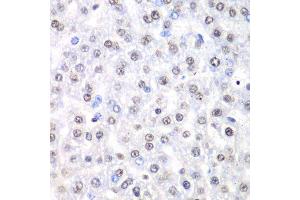 Immunohistochemistry of paraffin-embedded rat liver using Nono Antibody. (NONO anticorps  (AA 1-300))