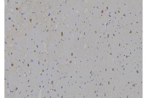 ABIN6277165 at 1/100 staining Human heart tissue by IHC-P.