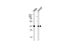 Western blot analysis of lysates from Hela, Jurkat cell line (from left to right), using FRG1 Antibody at 1:1000 at each lane. (FRG1 anticorps  (C-Term))
