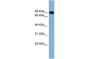 WB Suggested Anti-PSEN1  Antibody Titration: 0.