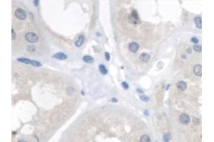 Detection of FUM in Human Kidney Tissue using Polyclonal Antibody to Fumarase (FUM)