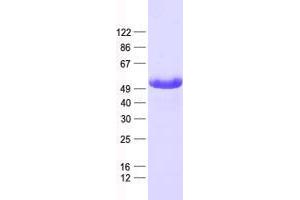 Validation with Western Blot