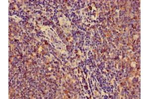 Immunohistochemistry of paraffin-embedded human lymph node tissue using ABIN7155625 at dilution of 1:100 (HLA-C anticorps  (AA 25-308))