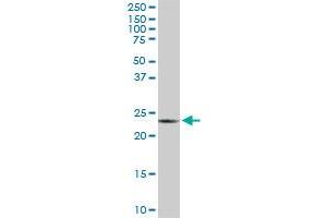 PGRMC2 monoclonal antibody (M04), clone 3C11.