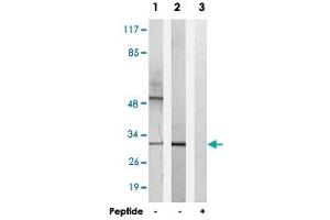 Western blot analysis of extracts from K-562 cells (Lane 1) and RAW 264. (HOXD10 anticorps)