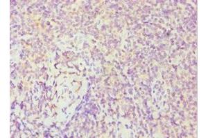 Immunohistochemistry of paraffin-embedded human tonsil tissue using ABIN7174019 at dilution of 1:100 (FES anticorps  (AA 120-420))