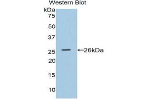 Western Blotting (WB) image for anti-Coagulation Factor VIII-Associated 1 (F8A1) (AA 171-375) antibody (ABIN1858769) (Coagulation Factor VIII-Associated 1 (F8A1) (AA 171-375) anticorps)