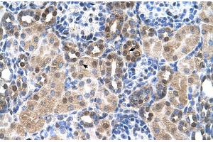 Human kidney (SLC46A3 anticorps  (N-Term))