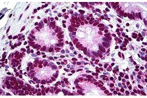 anti-LIM Homeobox 1 (LHX1) (AA 1-101) antibody