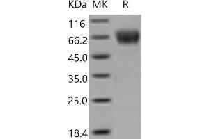 Western Blotting (WB) image for C-Type Lectin Domain Family 4, Member F (CLEC4F) protein (ABIN7194488)