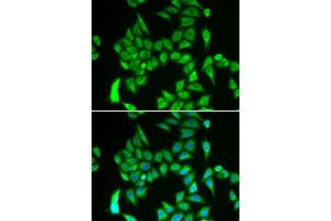Immunofluorescence analysis of A549 cells using IREB2 antibody (ABIN6292155). (IREB2 anticorps)