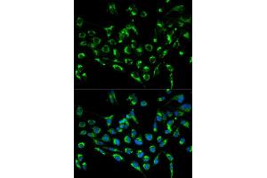 Immunofluorescence analysis of MCF7 cell using CDKN3 antibody. (CDKN3 anticorps)