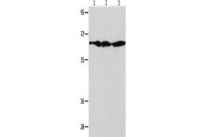 Western Blotting (WB) image for anti-Apoptosis-Inducing Factor, Mitochondrion-Associated, 1 (AIFM1) antibody (ABIN2421148) (AIF anticorps)
