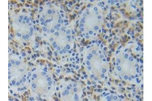 Detection of TREM1 in Human Stomach Tissue using Polyclonal Antibody to Triggering Receptor Expressed On Myeloid Cells 1 (TREM1)