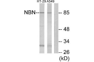 Western Blotting (WB) image for anti-Nibrin (NBN) (Internal Region) antibody (ABIN1850486) (Nibrin anticorps  (Internal Region))