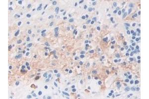 Detection of TPPP in Human Stomach Tissue using Polyclonal Antibody to Tubulin Polymerization Promoting Protein (TPPP) (Tppp anticorps  (AA 8-210))