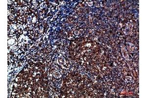 Immunohistochemical analysis of paraffin-embedded human-tonsil, antibody was diluted at 1:200