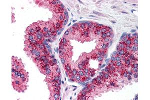 Anti-cIAP1 antibody IHC of human prostate. (BIRC2 anticorps  (C-Term))