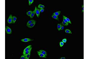 Immunofluorescence staining of HepG2 cells with ABIN7171957 at 1:400, counter-stained with DAPI. (TGFBR1 anticorps  (AA 157-244))