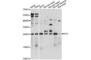 Western blot analysis of extracts of various cell lines, using RPE antibody. (RPE anticorps)