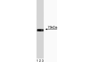 Western blot analysis of HS1 on human endothelial lysate. (HCLS1 anticorps  (AA 17-190))