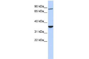 WB Suggested Anti-RNF207 Antibody Titration:  0. (RNF207 anticorps  (N-Term))