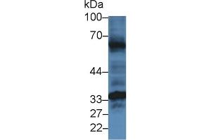 Detection of HJV in Mouse Heart lysate using Polyclonal Antibody to Hemojuvelin (HJV)