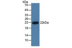 Detection of PSMb6 in Human Hela Cells using Polyclonal Antibody to Proteasome Subunit Beta Type 6 (PSMb6)