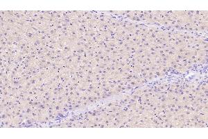 Detection of TIMP1 in Human Liver Tissue using Monoclonal Antibody to Tissue Inhibitors Of Metalloproteinase 1 (TIMP1)