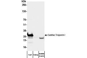 Western Blotting (WB) image for anti-Cardiac Troponin I (TNNI3) antibody (ABIN7795608) (TNNI3 anticorps)