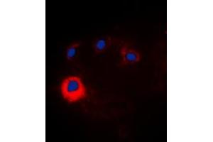 Immunofluorescent analysis of NOTCH1 staining in HeLa cells. (Notch1 anticorps  (Center))