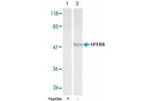 Western blot analysis of extracts from 293 cells using NFKBIB polyclonal antibody . (NFKBIB anticorps)