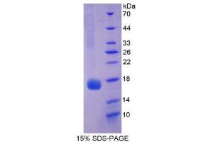 SDS-PAGE (SDS) image for Myoglobin (MB) (AA 1-154) protein (His tag) (ABIN1080355) (Myoglobin Protein (MB) (AA 1-154) (His tag))