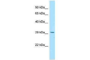 WB Suggested Anti-RWDD3 Antibody Titration: 1. (RWDD3 anticorps  (Middle Region))