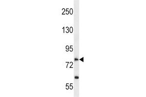Western Blotting (WB) image for anti-Solute Carrier Family 28 (Sodium-Coupled Nucleoside Transporter), Member 2 (SLC28A2) antibody (ABIN2998577)