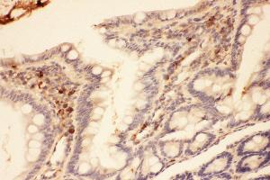 Anti-MMP7 Picoband antibody,  IHC(P): Rat intestines Tissue (MMP7 anticorps  (AA 95-264))