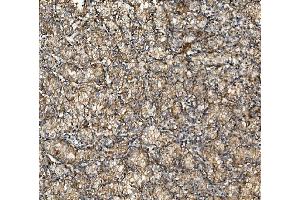 IHC analysis of NSF using anti-NSF antibody (ABIN7601630).