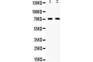 Observed bind size: 71 KD (FZD1 anticorps  (C-Term))