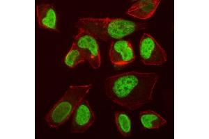 IF analysis of VPRBP/DCAF1 using anti-VPRBP/DCAF1 antibody (ABIN7602005). (DDB1 and CUL4-Associated Factor 1 (DCAF1) (AA 540-861) anticorps)