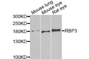 Western blot analysis of extracts of various cell lines, using RBP3 antibody. (RBP3 anticorps)