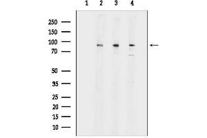 Western blot analysis of lysates from various samples, using beta Catenin Antibody.