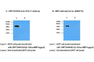 Transfected and non-transfected 293T cell lysates were resolved by SDS-PAGE, transferred to nitrocellulose membrane and probed with anti- ORF73/HHV8 (1:1,000) and anti-MBP (1:1,000). (HHV 8 (AA 122-329) anticorps)