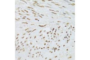 Immunohistochemistry of paraffin-embedded human uterus using DDB1 Antibody. (DDB1 anticorps)