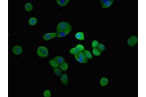 Immunofluorescent analysis of PC-3 cells using ABIN7169471 at dilution of 1:100 and Alexa Fluor 488-congugated AffiniPure Goat Anti-Rabbit IgG(H+L) (SH3TC2 anticorps  (AA 188-427))