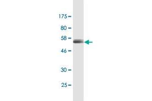 Western Blot detection against Immunogen (56. (CD320 anticorps  (AA 1-282))