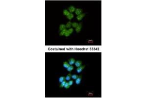 ICC/IF Image Immunofluorescence analysis of methanol-fixed A431, using Slap, antibody at 1:200 dilution. (SLA anticorps)