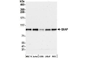 Western Blotting (WB) image for anti-Ubiquitin Protein Ligase E3A (ube3a) (AA 400-450) antibody (ABIN7449675)