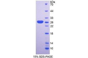 SDS-PAGE analysis of Mouse SNAG1 Protein. (SNX18 Protéine)