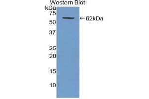 Western Blotting (WB) image for anti-Wingless-Type MMTV Integration Site Family, Member 5A (WNT5A) (AA 62-380) antibody (ABIN3210025) (WNT5A anticorps  (AA 62-380))
