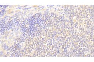 Detection of BLK in Human Lymph node Tissue using Polyclonal Antibody to B-Lymphoid Tyrosine Kinase (BLK)